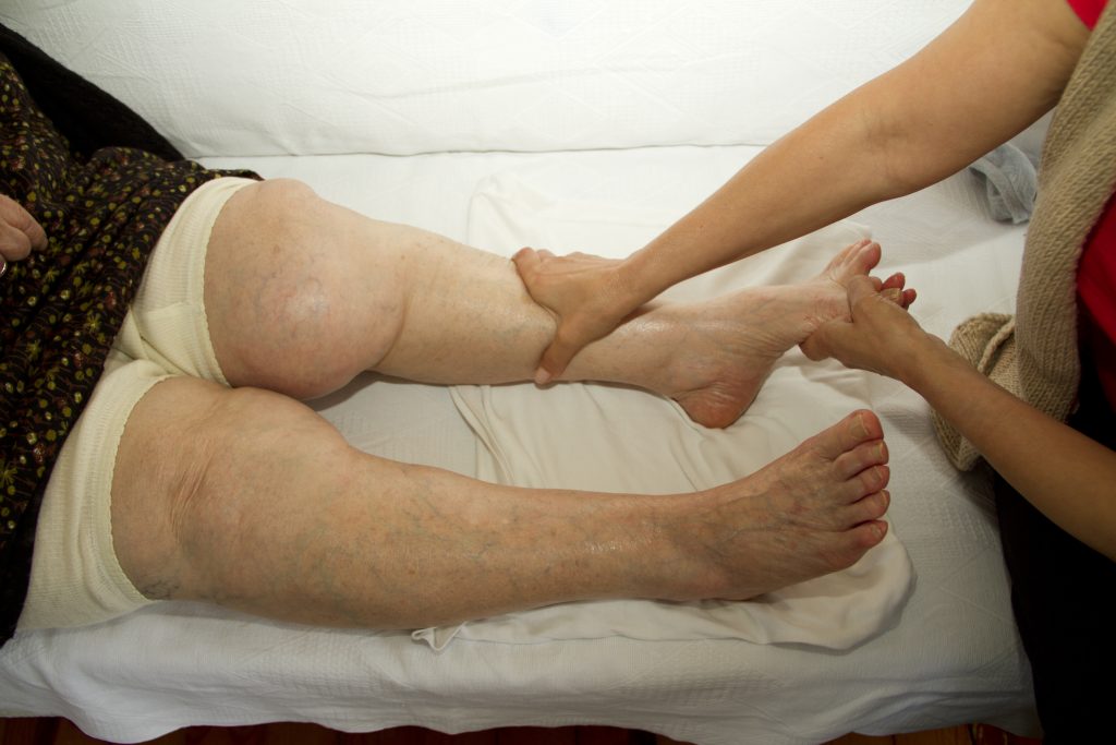Therapist massaging old woman's leg. Manual Lymphatic Drainage